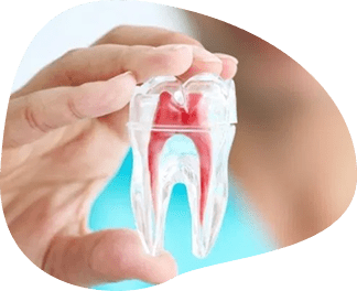 Root Canal Treatment In Manchester - The Vallance Dental Centre The Vallance Dental Centre Root Canal Treatment In Manchester - The Vallance Dental Centre The Vallance Dental Centre