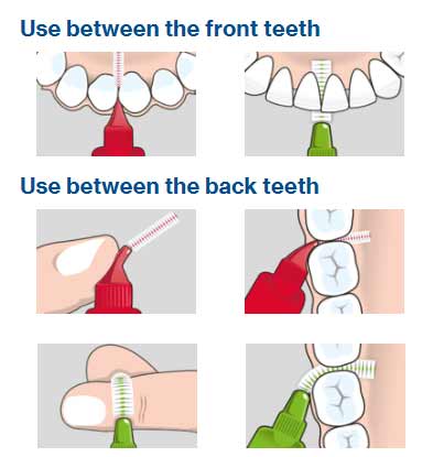 6 step diagram for using interdental brushes