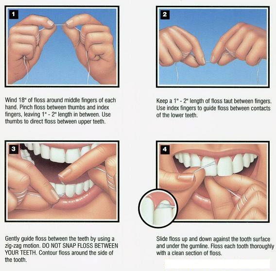 4 step diagram of flossing teeth instructions