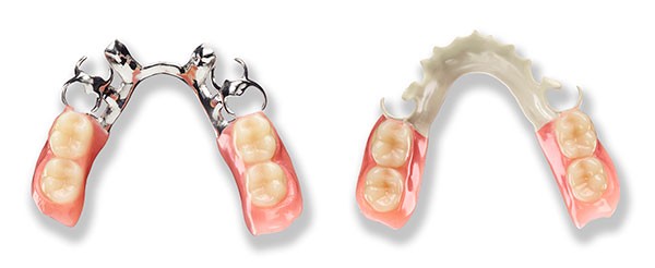 two partial denture sections