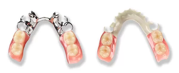 partial denture