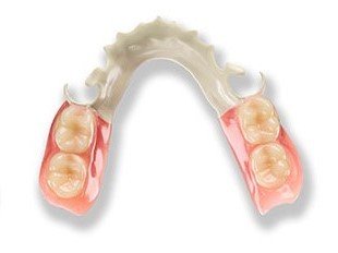 partial dentures for molars