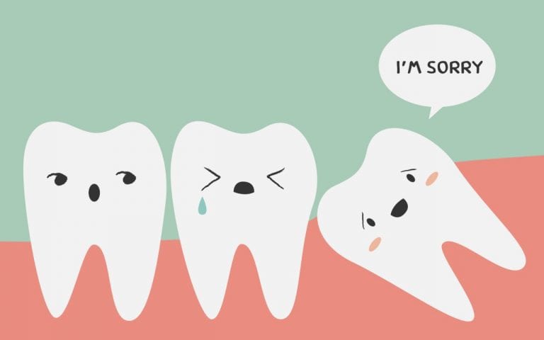 cartoon of wisdom tooth growing at an angle into other teeth