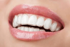 Invisalign®