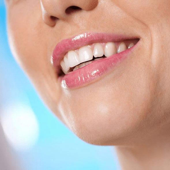 Tooth Whitening